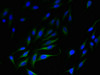 Immunofluorescent analysis of Hela cells using CSB-PA840985LA01HU at dilution of 1:100 and Alexa Fluor 488-congugated AffiniPure Goat Anti-Rabbit IgG (H+L)