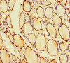 Immunohistochemistry of paraffin-embedded human thyroid tissue using CSB-PA841000LA01HU at dilution of 1:100