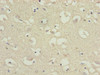 Immunohistochemistry of paraffin-embedded human brain tissue using CSB-PA842660LA01HU at dilution of 1:100