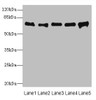 Western blot<br />
 All lanes: SPDL1 antibody at 4µg/ml<br />
 Lane 1: Hela whole cell lysate<br />
 Lane 2: 293T whole cell lysate<br />
 Lane 3: Jurkat whole cell lysate<br />
 Lane 4: A549 whole cell lysate<br />
 Lane 5: K562 whole cell lysate<br />
 Secondary<br />
 Goat polyclonal to rabbit IgG at 1/10000 dilution<br />
 Predicted band size: 71, 59, 62 kDa<br />
 Observed band size: 71 kDa<br />