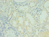 Immunohistochemistry of paraffin-embedded human kidney tissue using CSB-PA842727LA01HU at dilution of 1:100