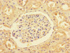 Immunohistochemistry of paraffin-embedded human kidney tissue using CSB-PA843146LA01HU at dilution of 1:100
