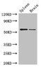 Western Blot<br />
 Positive WB detected in: Mouse spleen tissue, Mouse brain tissue<br />
 All lanes: D2HGDH antibody at 3µg/ml<br />
 Secondary<br />
 Goat polyclonal to rabbit IgG at 1/50000 dilution<br />
 Predicted band size: 57, 33, 35 kDa<br />
 Observed band size: 57 kDa<br />