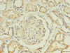 Immunohistochemistry of paraffin-embedded human kidney tissue using CSB-PA843276LA01HU at dilution of 1:100