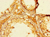 Immunohistochemistry of paraffin-embedded human testis tissue using CSB-PA843324LA01HU at dilution of 1:100 Immunohistochemistry of paraffin-embedded human testis tissue using CSB-PA843324LA01HU at dilution of 1:100