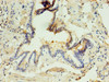 Immunohistochemistry of paraffin-embedded human lung tissue using CSB-PA845142EA01HU at dilution of 1:100