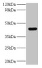 Western blot<br />
 All lanes: UBE2Q2 antibody at 2µg/ml + A431 whole cell lysate<br />
 Secondary<br />
 Goat polyclonal to rabbit IgG at 1/10000 dilution<br />
 Predicted band size: 43, 37, 41, 39 kDa<br />
 Observed band size: 43 kDa<br />