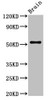 Western Blot<br />
 Positive WB detected in: Rat brain tissue<br />
 All lanes: ASZ1 antibody at 2.7µg/ml<br />
 Secondary<br />
 Goat polyclonal to rabbit IgG at 1/50000 dilution<br />
 Predicted band size: 54, 53 kDa<br />
 Observed band size: 54 kDa<br />
