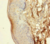 Immunohistochemistry of paraffin-embedded human skin tissue using CSB-PA846579LA01HU at dilution of 1:100