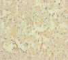 Immunohistochemistry of paraffin-embedded human liver tissue using CSB-PA846619LA01HU at dilution of 1:100