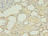 Immunohistochemistry of paraffin-embedded human kidney tissue using CSB-PA847219LA01HU at dilution of 1:100