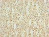 Immunohistochemistry of paraffin-embedded human adrenal gland tissue using CSB-PA847606LA01HU at dilution of 1:100