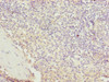 Immunohistochemistry of paraffin-embedded human spleen tissue using CSB-PA847628LA01HU at dilution of 1:100