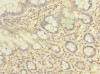 Immunohistochemistry of paraffin-embedded human small intestine tissue using CSB-PA847647LA01HU at dilution of 1:100