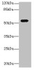 Western blot<br />
 All lanes: ICA1L antibody at 1.2µg/ml + MCF-7 whole cell lysate<br />
 Secondary<br />
 Goat polyclonal to rabbit IgG at 1/10000 dilution<br />
 Predicted band size: 55, 22 kDa<br />
 Observed band size: 55 kDa<br />