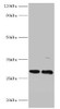 Western blot<br />
 All lanes: PIGX antibody at 2µg/ml<br />
 Lane 1: Mouse kidney tissue<br />
 Lane 2: 293T whole cell lysate<br />
 Secondary<br />
 Goat polyclonal to rabbit IgG at 1/10000 dilution<br />
 Predicted band size: 29, 31 kDa<br />
 Observed band size: 29 kDa<br /> Western blot<br />
 All lanes: PIGX antibody at 2µg/ml<br />
 Lane 1: Mouse kidney tissue<br />
 Lane 2: 293T whole cell lysate<br />
 Secondary<br />
 Goat polyclonal to rabbit IgG at 1/10000 dilution<br />
 Predicted band size: 29, 31 kDa<br />
 Observed band size: 29 kDa<br />