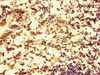 Immunohistochemistry of paraffin-embedded human appendix tissue using CSB-PA848832LA01HU at dilution of 1:100