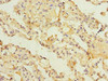 Immunohistochemistry of paraffin-embedded human lung tissue using CSB-PA850249LA01HU at dilution of 1:100