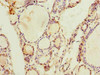Immunohistochemistry of paraffin-embedded human thyroid tissue using CSB-PA850249LA01HU at dilution of 1:100