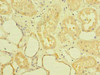 Immunohistochemistry of paraffin-embedded human kidney tissue using CSB-PA850251LA01HU at dilution of 1:100 Immunohistochemistry of paraffin-embedded human kidney tissue using CSB-PA850251LA01HU at dilution of 1:100