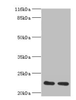 Western blot<br />
 All lanes: RERG antibody at 2µg/ml<br />
 Lane 1: Mouse thymus tissue<br />
 Lane 2: Rat lung tissue<br />
 Secondary<br />
 Goat polyclonal to rabbit IgG at 1/10000 dilution<br />
 Predicted band size: 23, 21 kDa<br />
 Observed band size: 23 kDa<br /> Western blot<br />
 All lanes: RERG antibody at 2µg/ml<br />
 Lane 1: Mouse thymus tissue<br />
 Lane 2: Rat lung tissue<br />
 Secondary<br />
 Goat polyclonal to rabbit IgG at 1/10000 dilution<br />
 Predicted band size: 23, 21 kDa<br />
 Observed band size: 23 kDa<br />