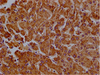 Immunohistochemistry of paraffin-embedded human liver tissue using CSB-PA850772LA01HU at dilution of 1:100