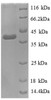 (Tris-Glycine gel) Discontinuous SDS-PAGE (reduced) with 5% enrichment gel and 15% separation gel.