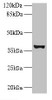 Western blot<br />
 All lanes: UBLCP1 antibody at 0.2µg/ml + U251 whole cell lysate<br />
 Secondary<br />
 Goat polyclonal to rabbit IgG at 1/10000 dilution<br />
 Predicted band size: 37 kDa<br />
 Observed band size: 37 kDa<br />