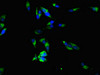 Immunofluorescent analysis of Hela cells using CSB-PA853385LA01HU at dilution of 1:100 and Alexa Fluor 488-congugated AffiniPure Goat Anti-Rabbit IgG (H+L)
