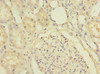 Immunohistochemistry of paraffin-embedded human kidney tissue using CSB-PA853398LA01HU at dilution of 1:100