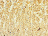 Immunohistochemistry of paraffin-embedded human adrenal gland tissue using CSB-PA853410LA01HU at dilution of 1:100