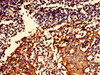 Immunohistochemistry of paraffin-embedded human tonsil tissue using CSB-PA853418LA01HU at dilution of 1:100