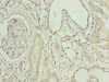 Immunohistochemistry of paraffin-embedded human kidney tissue using CSB-PA853424LA01HU at dilution of 1:100