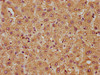 IHC image of CSB-PA854045LA01HU diluted at 1:50 and staining in paraffin-embedded human liver tissue performed on a Leica BondTM system. After dewaxing and hydration, antigen retrieval was mediated by high pressure in a citrate buffer (pH 6.0) . Section was blocked with 10% normal goat serum 30min at RT. Then primary antibody (1% BSA) was incubated at 4°C overnight. The primary is detected by a biotinylated secondary antibody and visualized using an HRP conjugated SP system.