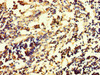 Immunohistochemistry of paraffin-embedded human appendix tissue using CSB-PA855034LA01HU at dilution of 1:100