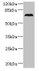 Western blot<br />
 All lanes: CEP76 antibody at 0.5µg/ml + 293T whole cell lysate<br />
 Secondary<br />
 Goat polyclonal to rabbit IgG at 1/10000 dilution<br />
 Predicted band size: 75, 66, 30 kDa<br />
 Observed band size: 75 kDa<br />