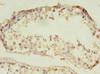 Immunohistochemistry of paraffin-embedded human testis tissue using CSB-PA855485LA01HU at dilution of 1:100