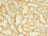 Immunohistochemistry of paraffin-embedded human kidney tissue using CSB-PA855490LA01HU at dilution of 1:100