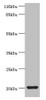 Western blot<br />
 All lanes: MYLPF antibody at 2µg/ml + Mouse skeletal muscle tissue<br />
 Secondary<br />
 Goat polyclonal to rabbit IgG at 1/10000 dilution<br />
 Predicted band size: 20 kDa<br />
 Observed band size: 20 kDa<br />
