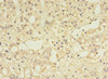 Immunohistochemistry of paraffin-embedded human adrenal gland tissue using CSB-PA858710HA01HU at dilution of 1:100