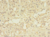 Immunohistochemistry of paraffin-embedded human adrenal gland tissue using CSB-PA858710HA01HU at dilution of 1:100 Immunohistochemistry of paraffin-embedded human adrenal gland tissue using CSB-PA858710HA01HU at dilution of 1:100
