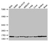 Western Blot<br />
 Positive WB detected in: Hela whole cell lysate, Jurkat whole cell lysate, SH-SY5Y whole cell lysate, HEK293 whole cell lysate, Mouse lung tissue, Mouse liver tissue, Mouse kidney tissue, Mouse brain tissue<br />
 All lanes: PAIP2 antibody at 3.5µg/ml<br />
 Secondary<br />
 Goat polyclonal to rabbit IgG at 1/50000 dilution<br />
 Predicted band size: 15 kDa<br />
 Observed band size: 15 kDa<br />