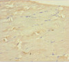 Immunohistochemistry of paraffin-embedded human skeletal muscle tissue using CSB-PA859030LA01HU at dilution of 1:100
