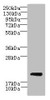 Western blot<br />
 All lanes: CYBC1 antibody at 1.5µg/ml + Mouse liver tissue<br />
 Secondary<br />
 Goat polyclonal to rabbit IgG at 1/10000 dilution<br />
 Predicted band size: 21, 20 kDa<br />
 Observed band size: 21 kDa<br />