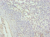 Immunohistochemistry of paraffin-embedded human tonsil tissue using CSB-PA859832LA01HU at dilution of 1:100