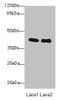 Western blot<br />
 All lanes: P2RY13 antibody at 3µg/ml<br />
 Lane 1: HT29 whole cell lysate<br />
 Lane 2: Colo320 whole cell lysate<br />
 Secondary<br />
 Goat polyclonal to rabbit IgG at 1/10000 dilution<br />
 Predicted band size: 41, 39 kDa<br />
 Observed band size: 41 kDa<br /> Western blot<br />
 All lanes: P2RY13 antibody at 3µg/ml<br />
 Lane 1: HT29 whole cell lysate<br />
 Lane 2: Colo320 whole cell lysate<br />
 Secondary<br />
 Goat polyclonal to rabbit IgG at 1/10000 dilution<br />
 Predicted band size: 41, 39 kDa<br />
 Observed band size: 41 kDa<br />