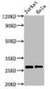 Western Blot<br />
 Positive WB detected in: Jurkat whole cell lysate, Hela whole cell lysate<br />
 All lanes: HSD17B10 antibody at 3µg/ml<br />
 Secondary<br />
 Goat polyclonal to rabbit IgG at 1/50000 dilution<br />
 Predicted band size: 27, 26 kDa<br />
 Observed band size: 27 kDa<br />