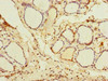 Immunohistochemistry of paraffin-embedded human thyroid tissue using CSB-PA861080LA01HU at dilution of 1:100