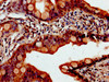 IHC image of CSB-PA861141HA01HU diluted at 1:800 and staining in paraffin-embedded human small intestine tissue performed on a Leica BondTM system. After dewaxing and hydration, antigen retrieval was mediated by high pressure in a citrate buffer (pH 6.0) . Section was blocked with 10% normal goat serum 30min at RT. Then primary antibody (1% BSA) was incubated at 4°C overnight. The primary is detected by a biotinylated secondary antibody and visualized using an HRP conjugated SP system.