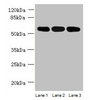 Western blot<br />
 All lanes: STK33 antibody at 4µg/ml<br />
 Lane 1: Mouse kidney tissue<br />
 Lane 2: Hela whole cell lysate<br />
 Lane 3: Jurkat whole cell lysate<br />
 Secondary<br />
 Goat polyclonal to rabbit IgG at 1/10000 dilution<br />
 Predicted band size: 58, 51 kDa<br />
 Observed band size: 58 kDa<br />